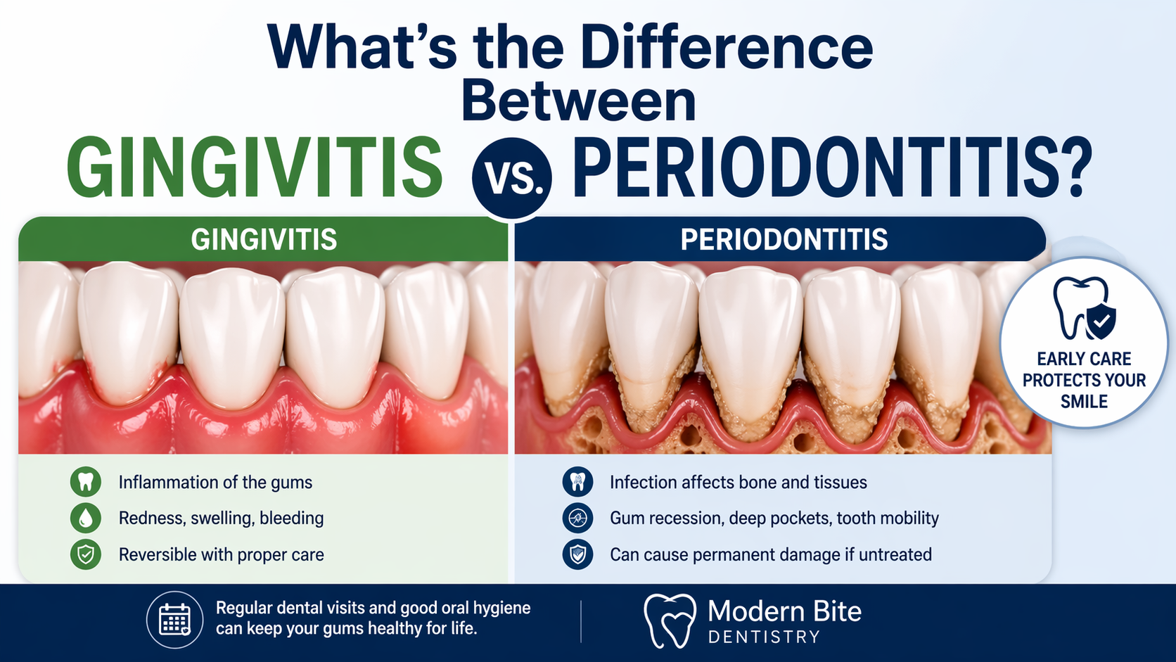 Difference Between Gingivitis and Periodontitis